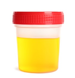 Container with urine sample for analysis isolated on white