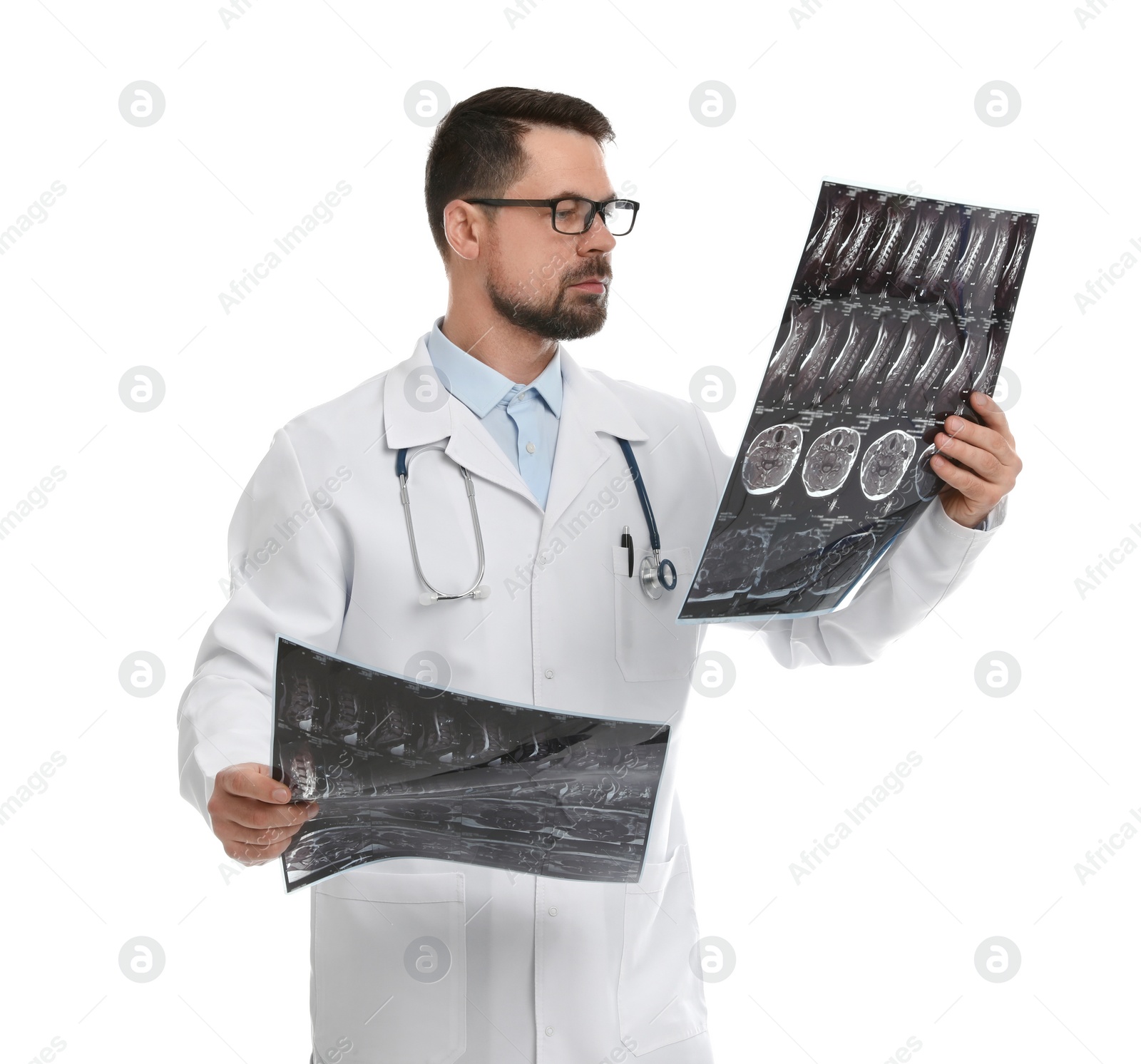 Photo of Orthopedist holding X-ray pictures on white background