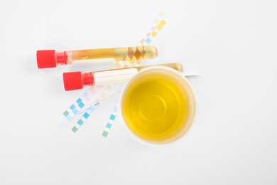 Laboratory ware with urine samples for analysis on white background, top view