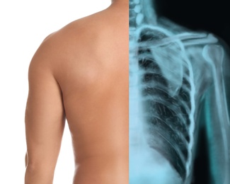 Image of Man, back closeup view, half x-ray photograph. Medical check