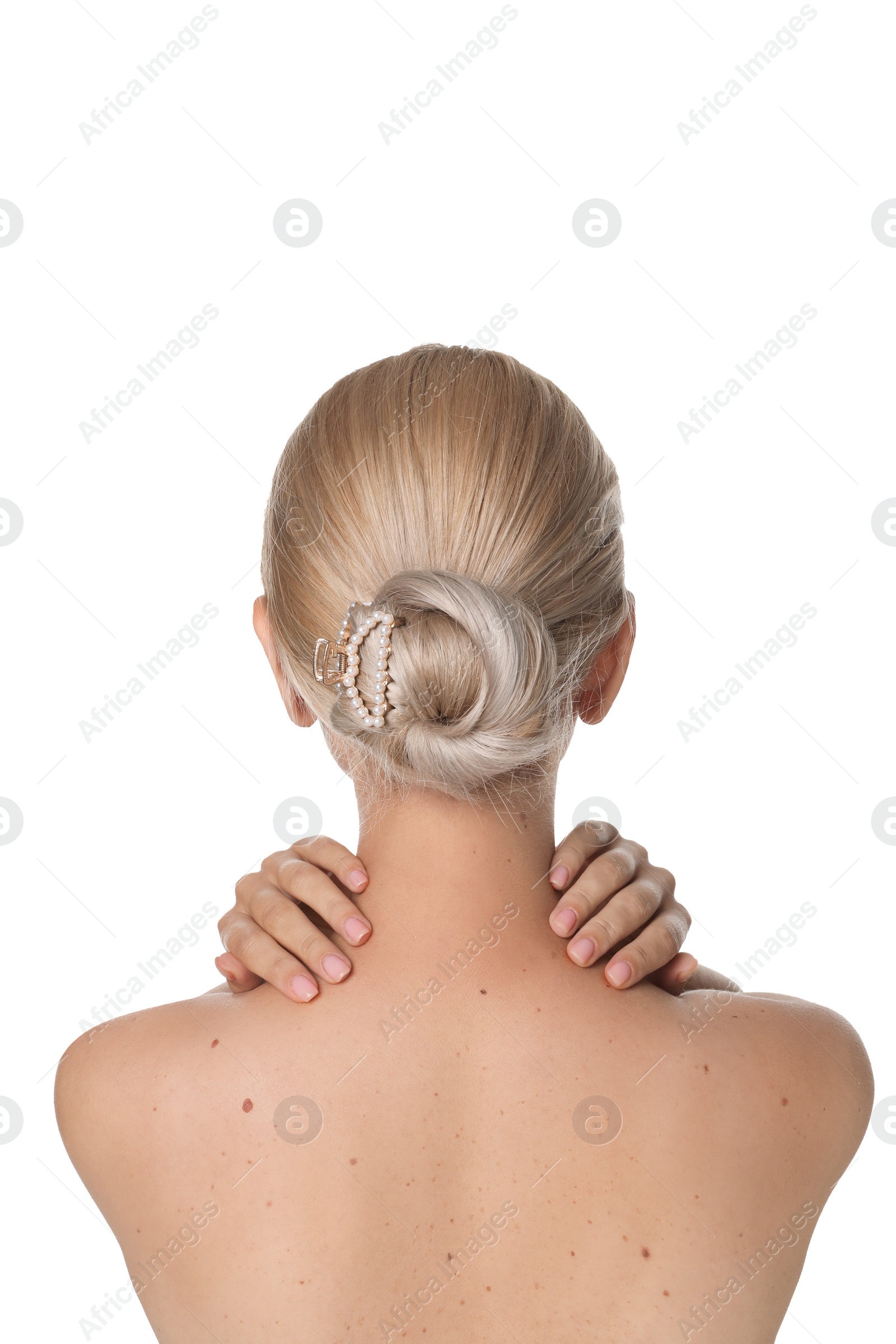 Photo of Woman with birthmarks on white background, back view