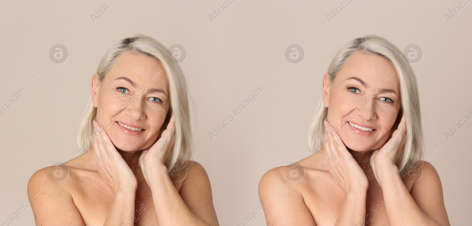 Image of Photo before and after retouch, collage. Portrait of beautiful mature woman on beige background, banner design