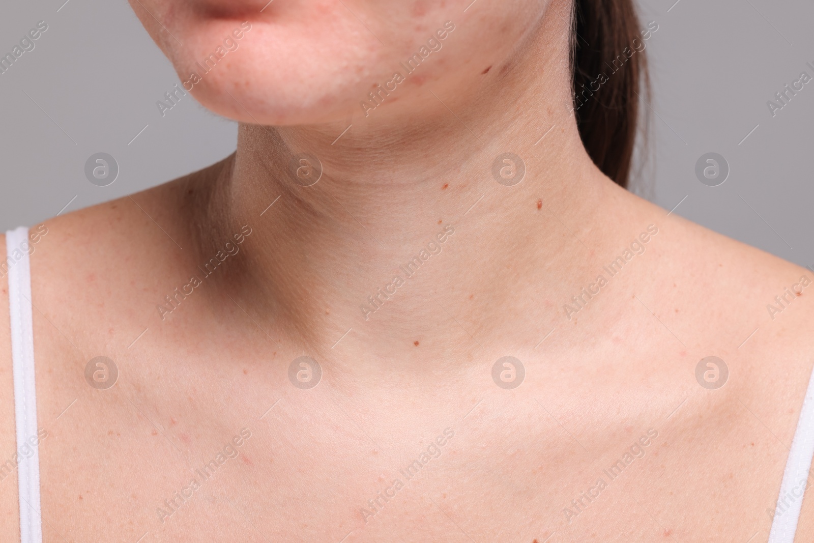 Photo of Closeup view of woman with normal skin on grey background