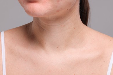 Closeup view of woman with normal skin on grey background