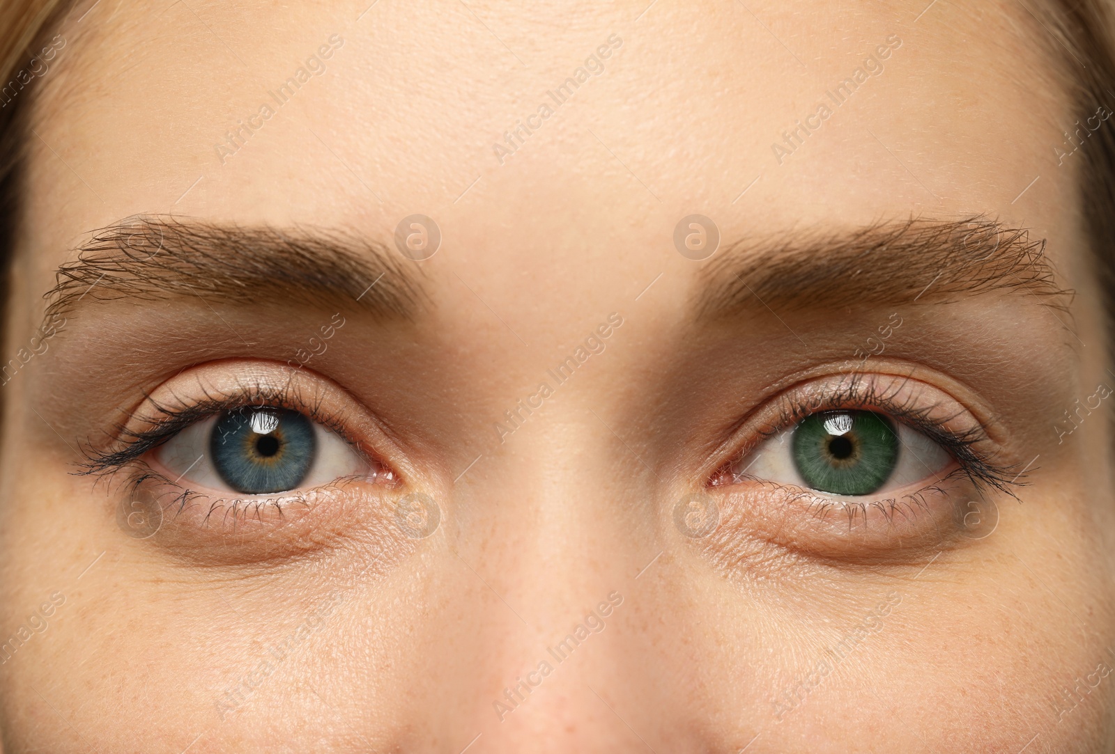 Image of Woman with beautiful eyes of different colors, closeup. Heterochromia iridis