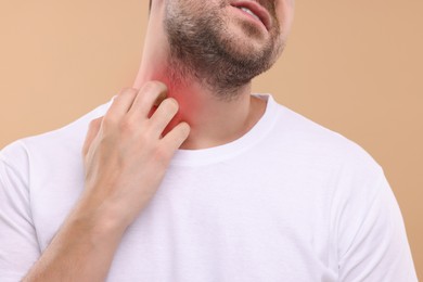 Photo of Allergy symptom. Man scratching his neck on light brown background, closeup