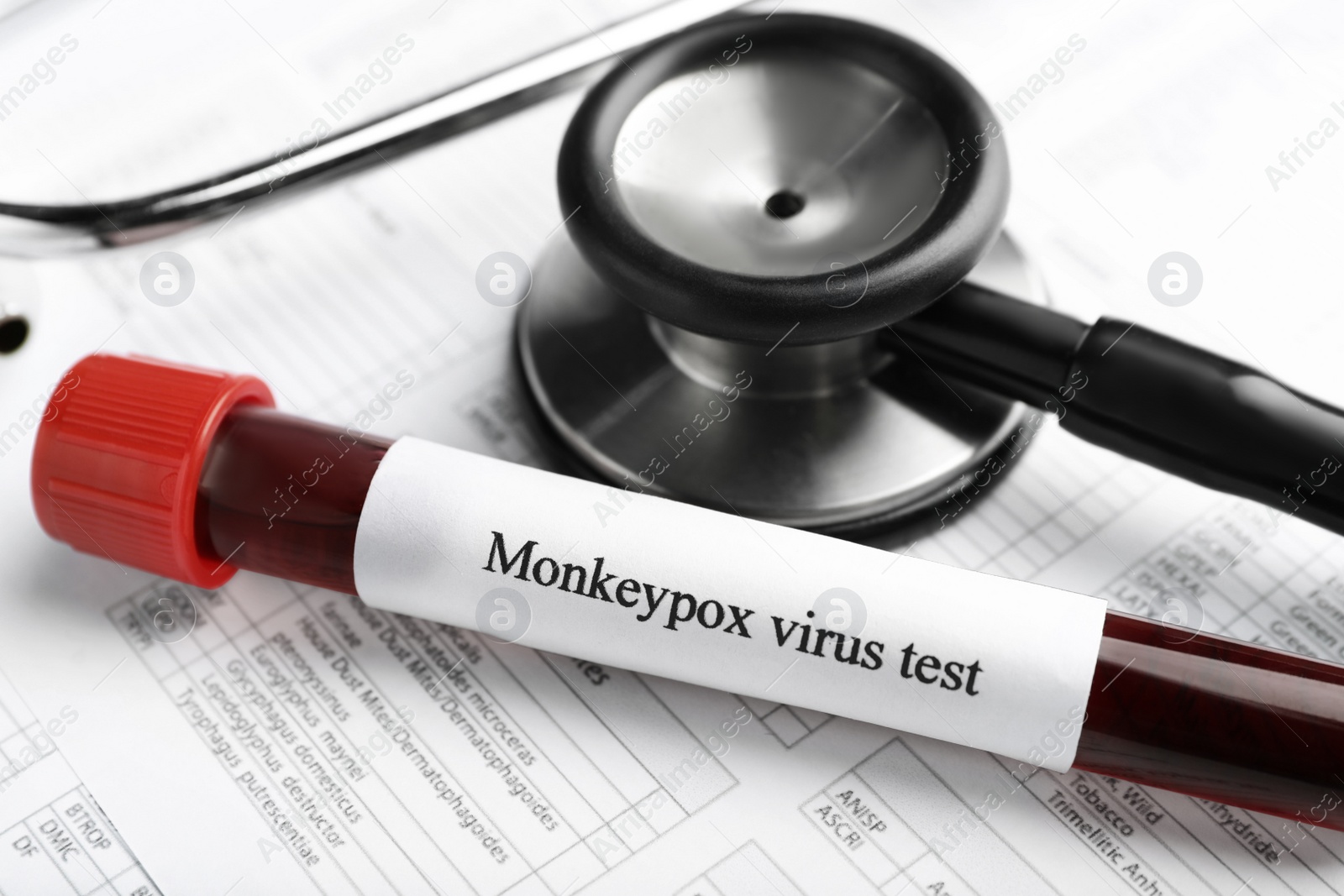 Photo of Monkeypox virus test. Sample tube with blood and stethoscope on medical form, closeup