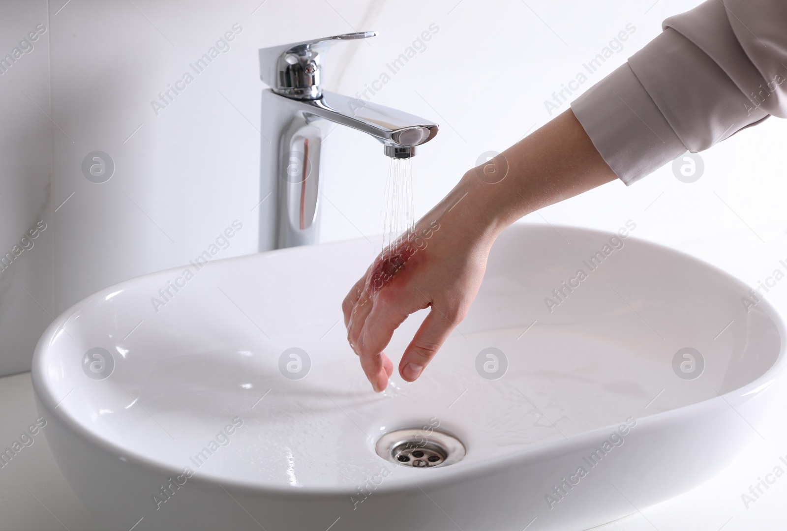 Photo of Woman putting burned hand under running cold water indoors, closeup