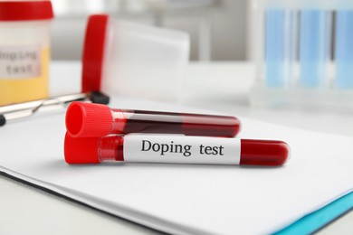 Photo of Test tubes with blood samples on white table. Doping control