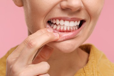 Woman showing her clean teeth on pink background, closeup