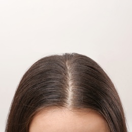 Photo of Woman with dandruff in her dark hair on light background, closeup view. Space for text