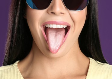 Image of Young woman showing tongue with white patches on violet background, closeup. Oral candidiasis (thrush) disease