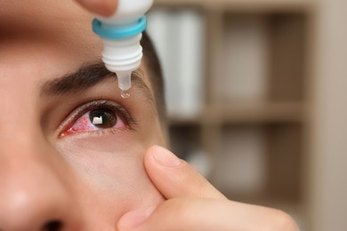 Image of Man using eye drops on blurred background, closeup