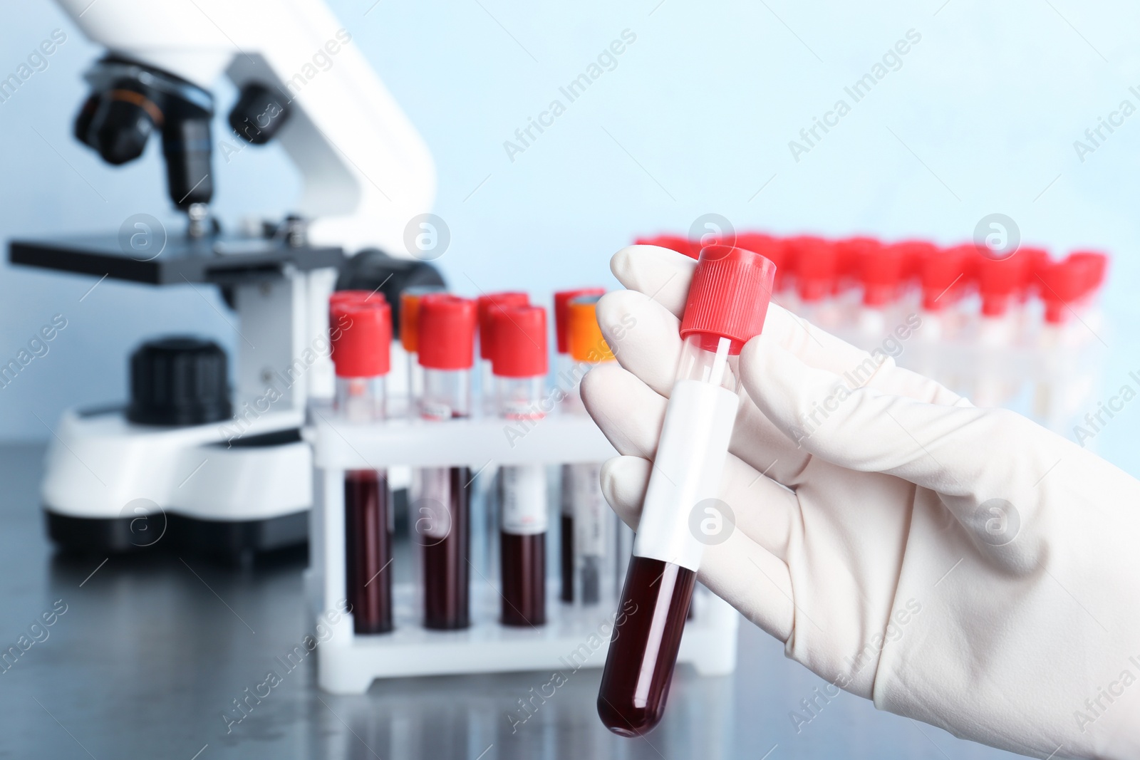 Photo of Doctor holding glass tube with blood in laboratory, closeup. Allergy test