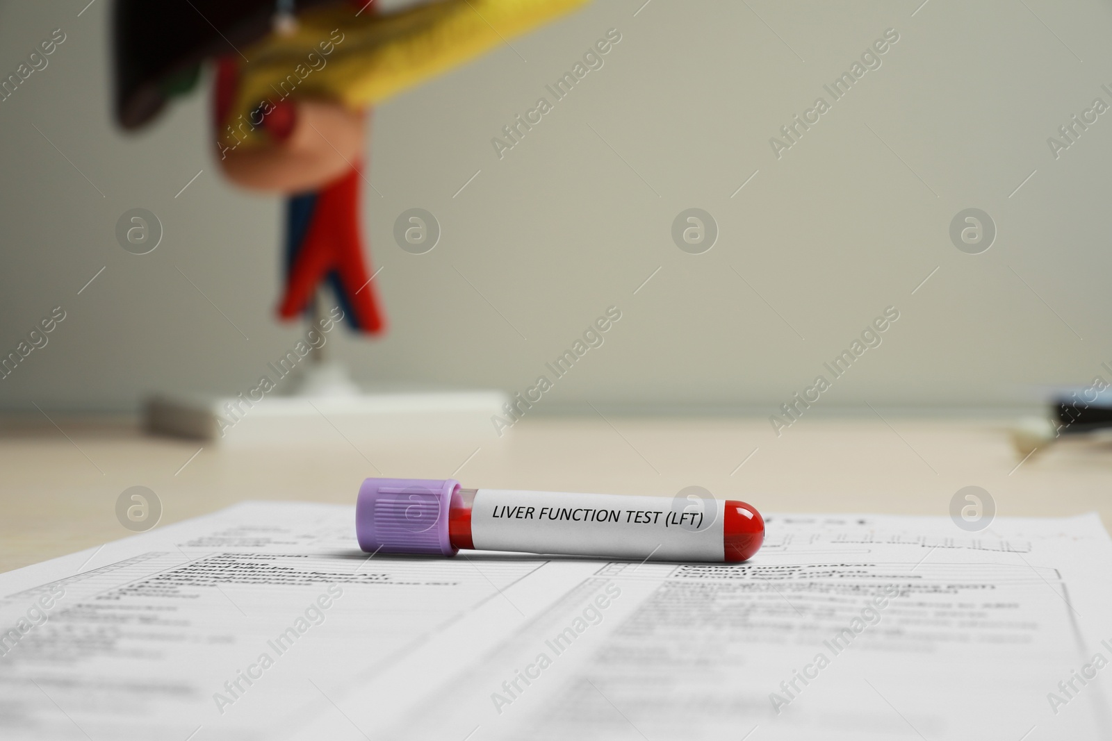 Photo of Liver Function Test. Tube with blood sample and laboratory form on table, closeup