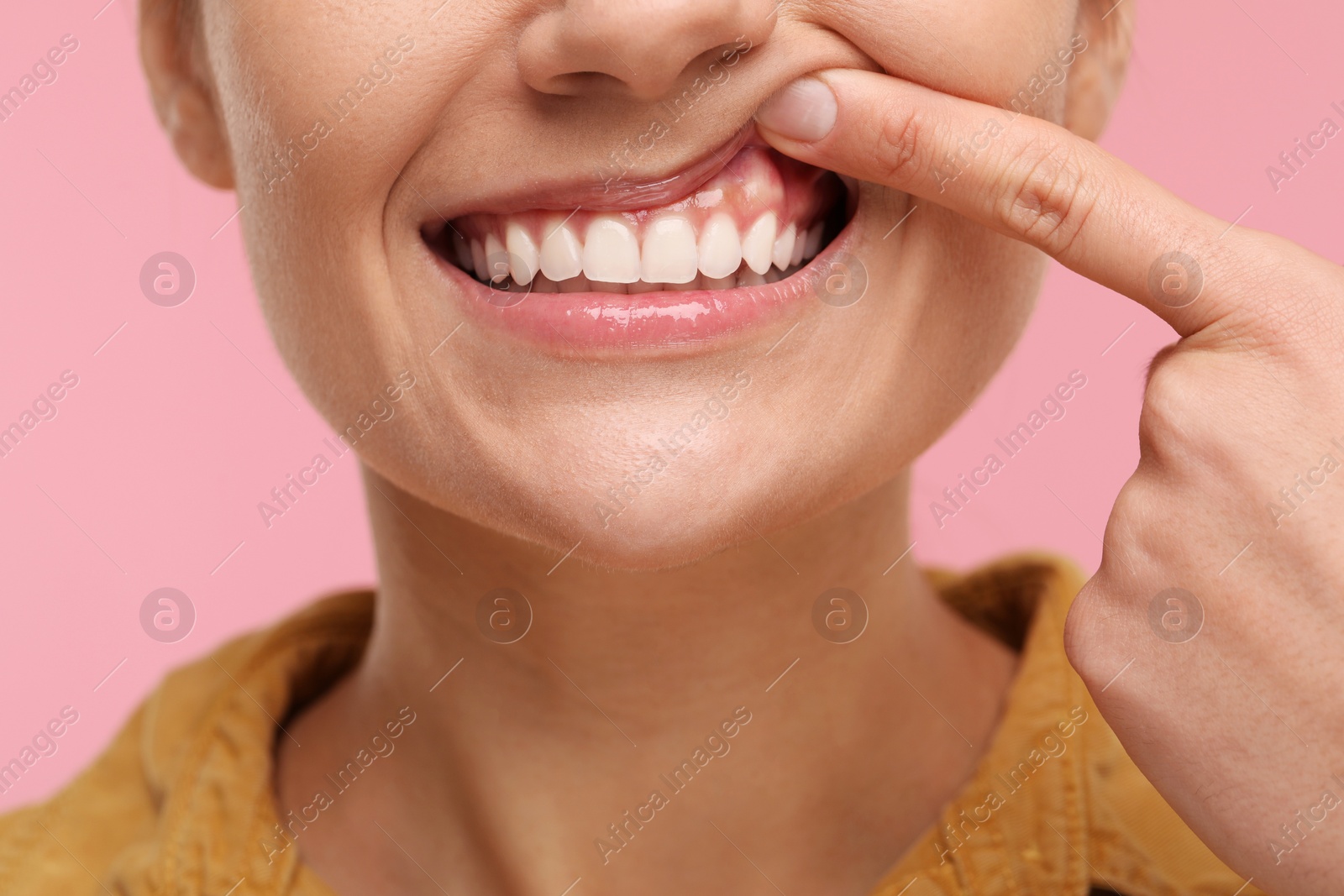 Photo of Woman showing her clean teeth on pink background, closeup
