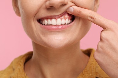 Woman showing her clean teeth on pink background, closeup