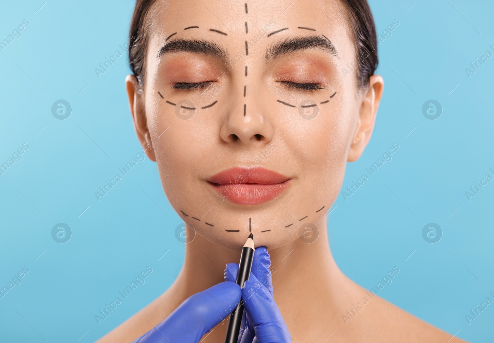 Photo of Doctor drawing marks on woman's face for cosmetic surgery operation against light blue background