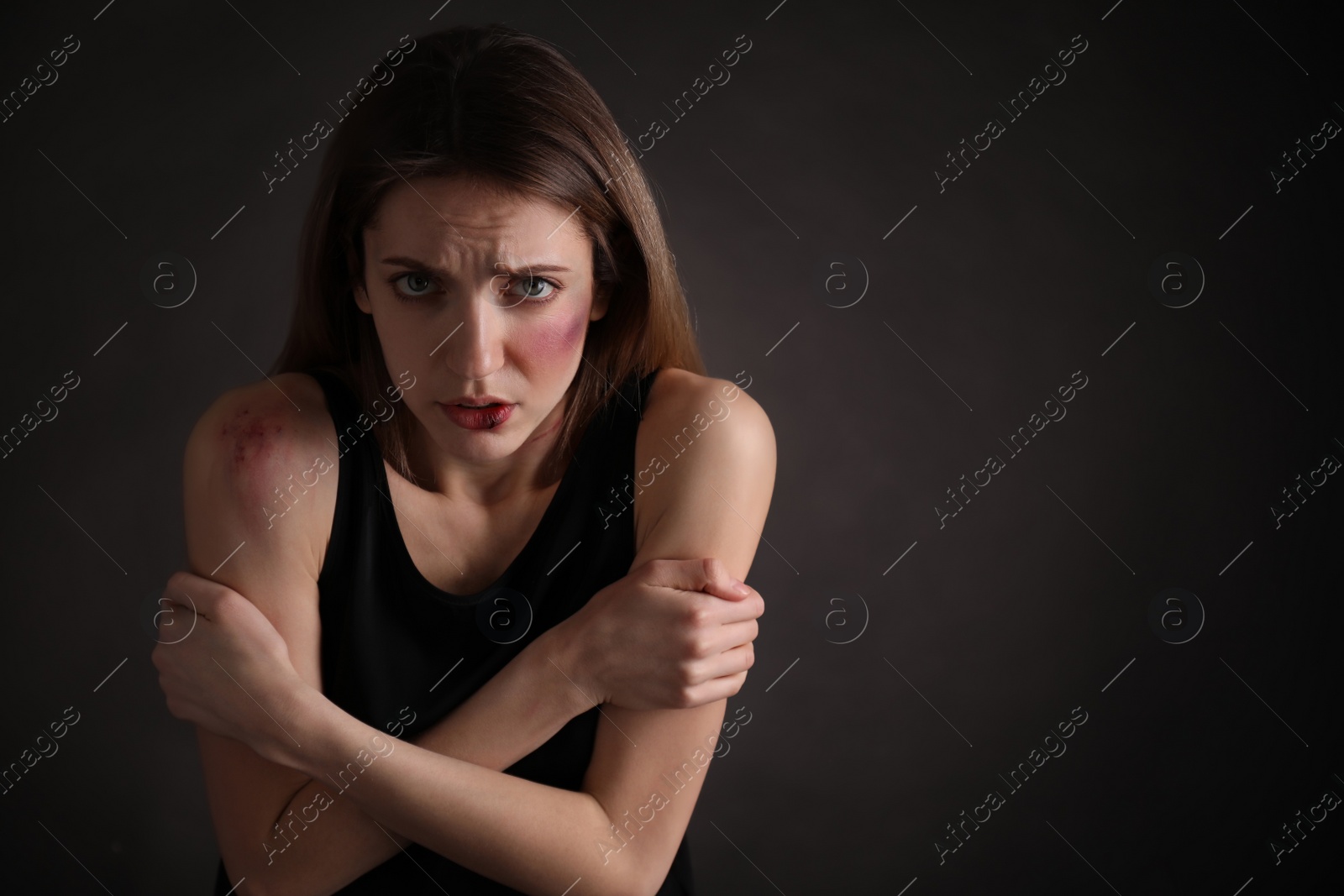 Photo of Woman with facial injuries on black background, space for text. Domestic violence victim