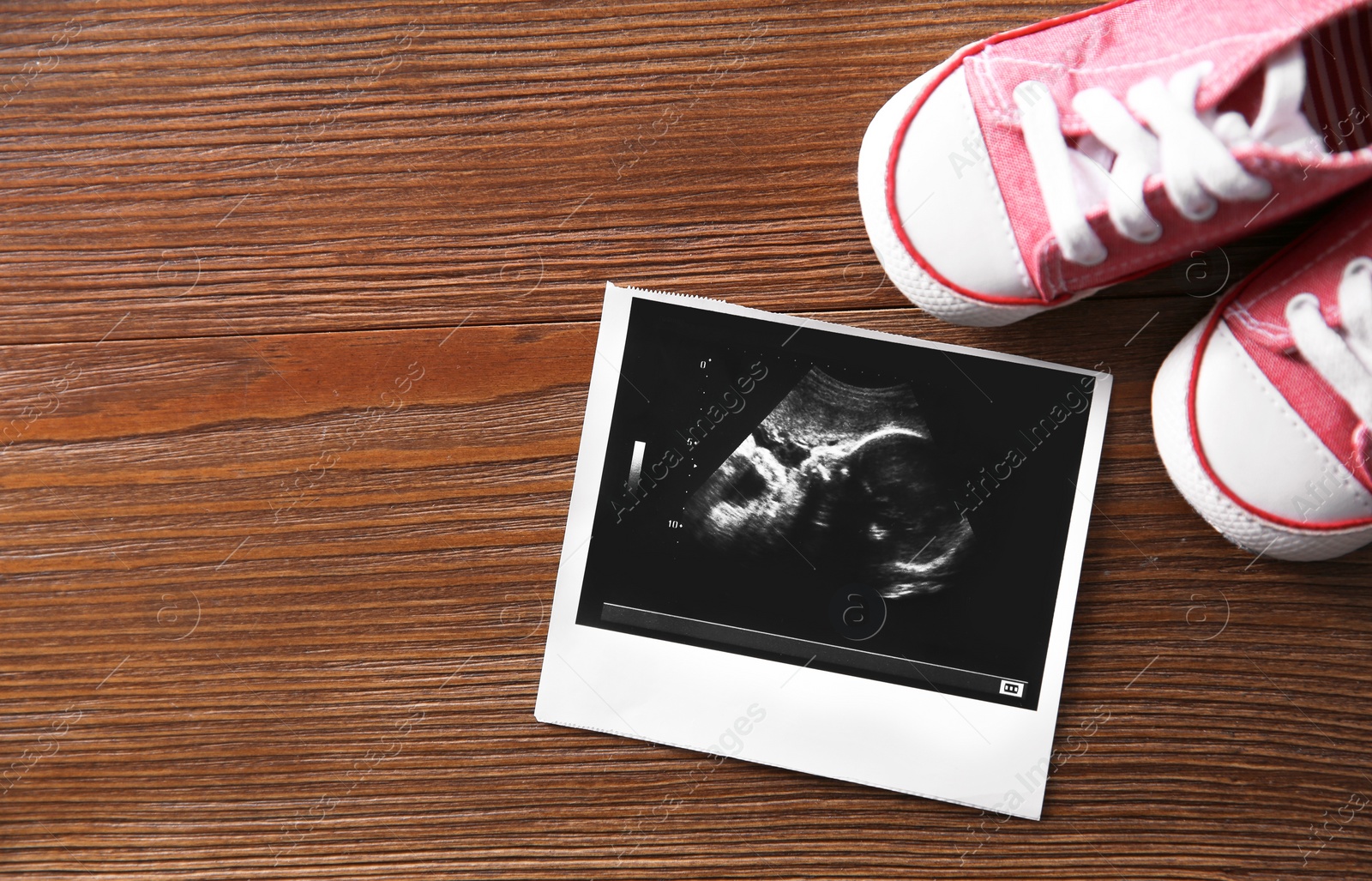Photo of Ultrasound picture and baby shoes on wooden background, top view with space for text