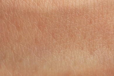 Photo of Texture of dry skin as background, macro view