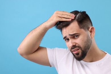 Emotional man with dandruff in his dark hair on light blue background