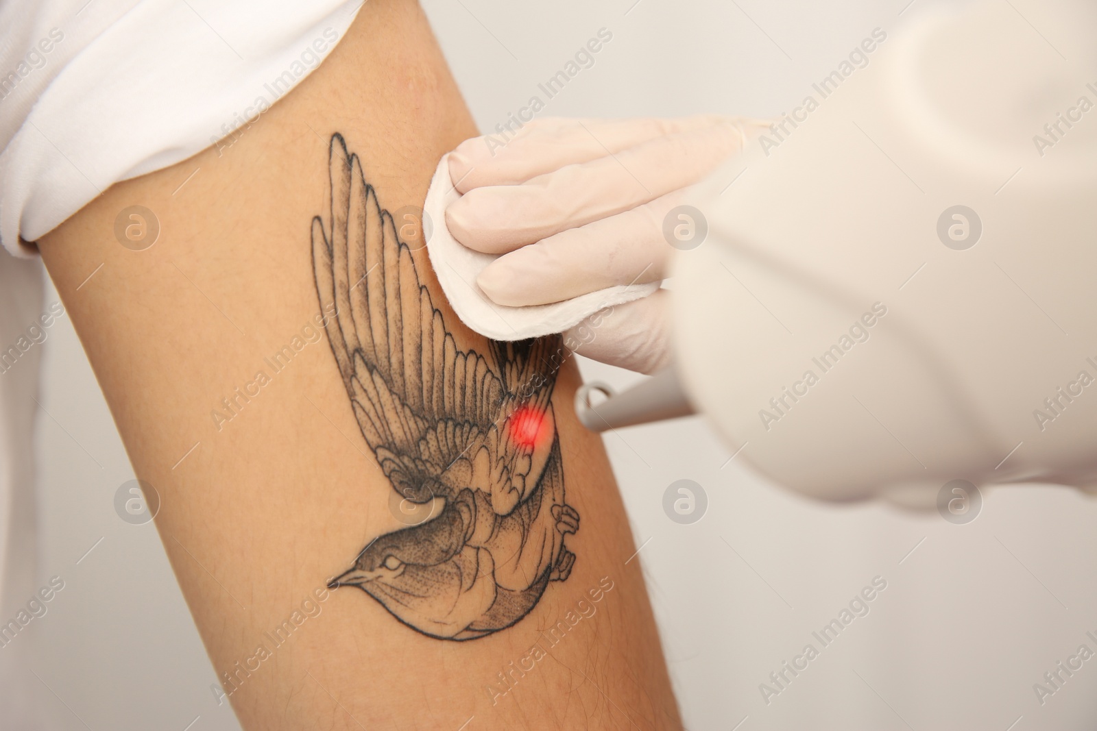 Photo of Young man undergoing laser tattoo removal procedure in salon, closeup