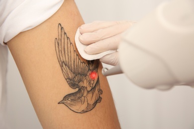 Photo of Young man undergoing laser tattoo removal procedure in salon, closeup