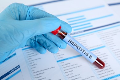 Photo of Scientist holding tube with blood sample and label Hepatitis B against laboratory test form, closeup