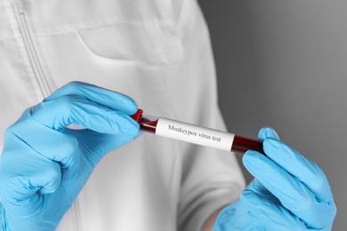 Monkeypox virus diagnosis. Laboratory worker holding test tube with blood sample on grey background, closeup