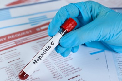 Photo of Scientist holding tube with blood sample and label Hepatitis C against laboratory test forms, closeup