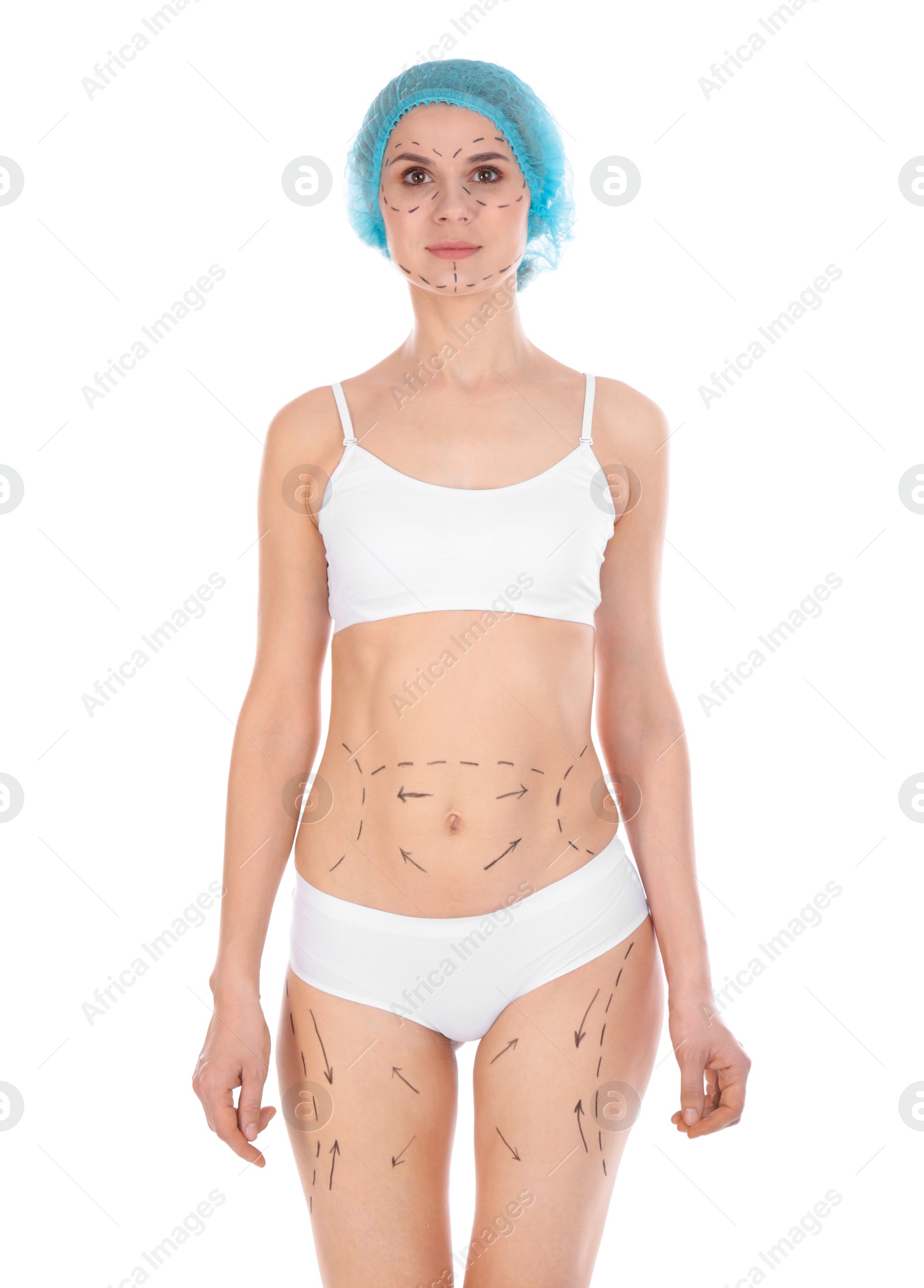 Photo of Woman with marks on body for cosmetic surgery operation against white background