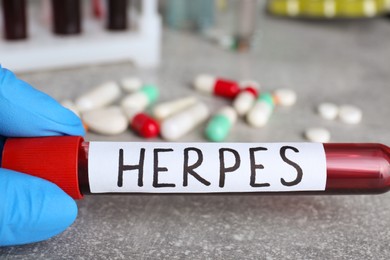 Doctor in glove holding test tube with word Herpes at light grey table, closeup