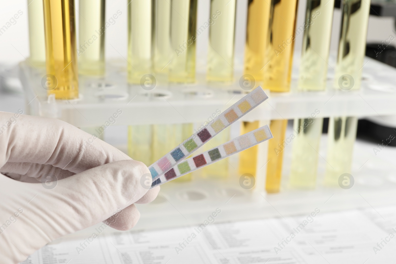 Photo of Nurse holding tube with urine sample for analysis at table, closeup