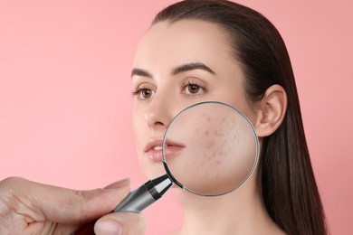 Image of Dermatologist looking at woman's face with magnifying glass on pink background, closeup. Zoomed view on acne