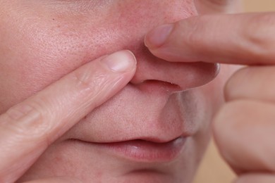 Photo of Woman popping pimple on her nose, closeup