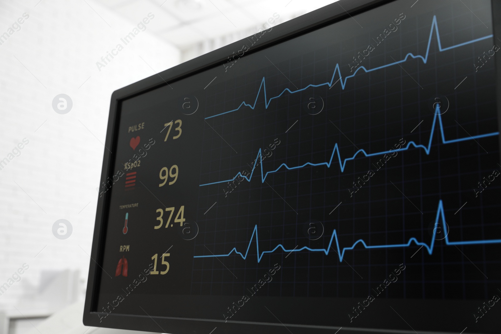 Photo of Black monitor with cardiogram in hospital, closeup