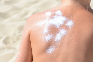 Child with sunscreen on back at beach, closeup