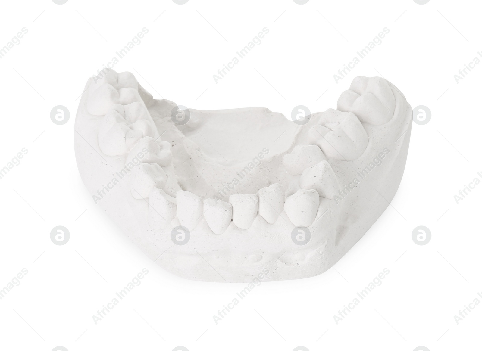 Photo of Dental model with gum isolated on white. Cast of teeth