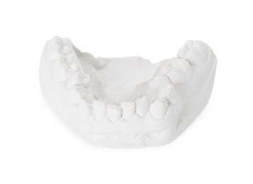 Photo of Dental model with gum isolated on white. Cast of teeth