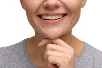 Woman with clean teeth smiling on white background, closeup