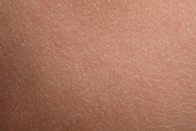 Photo of Closeup view of human skin as background