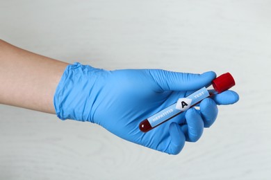 Photo of Scientist holding tube with blood sample and label Hepatitis A test on light background, closeup