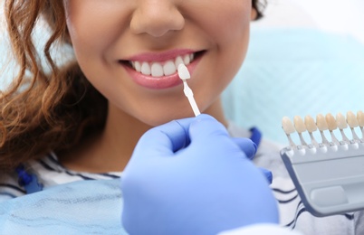 Dentist matching patient's teeth color with palette, closeup