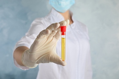 Photo of Doctor holding test tube with urine sample for analysis on light blue background, closeup