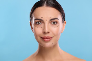 Young woman with marks on face for cosmetic surgery operation against light blue background