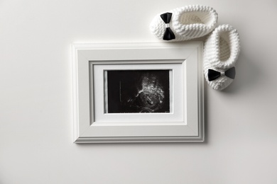 Photo of Ultrasound photo of baby and knitted boots on white background, top view