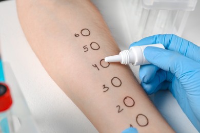 Photo of Doctor doing skin allergy test at light table, closeup