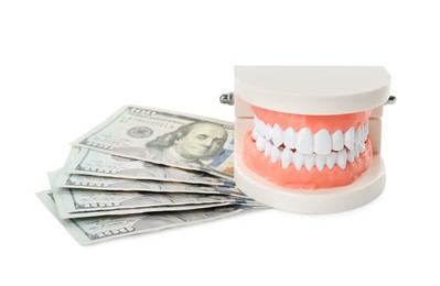 Photo of Educational dental typodont model and dollar banknotes on white background. Expensive treatment