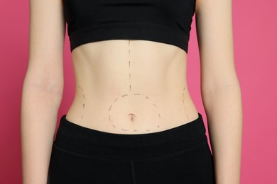Photo of Slim woman with marks on body against pink background, closeup. Weight loss surgery